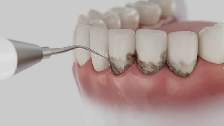 Trusted Wisdom Tooth Removal service in Magalia, CA - Dentist Open Now